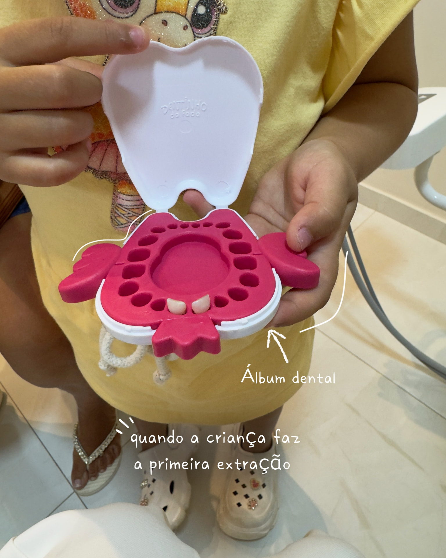 Registro do primeiro dentinho no álbum dental
